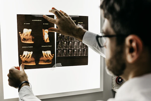 Especialista realizando implantes de carga inmediata